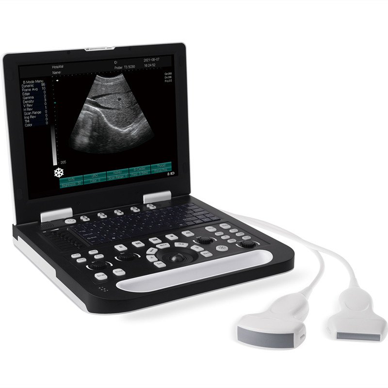 Ultrasonido Laptop Marshall Color Y Pulsado Con Transductor Nuevo