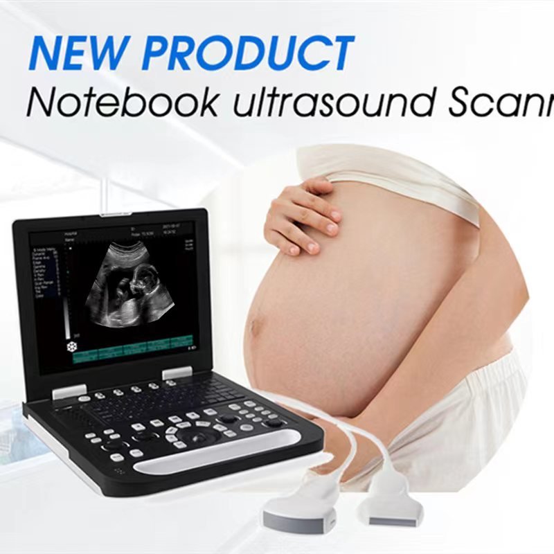 venta de ultrasonidos3