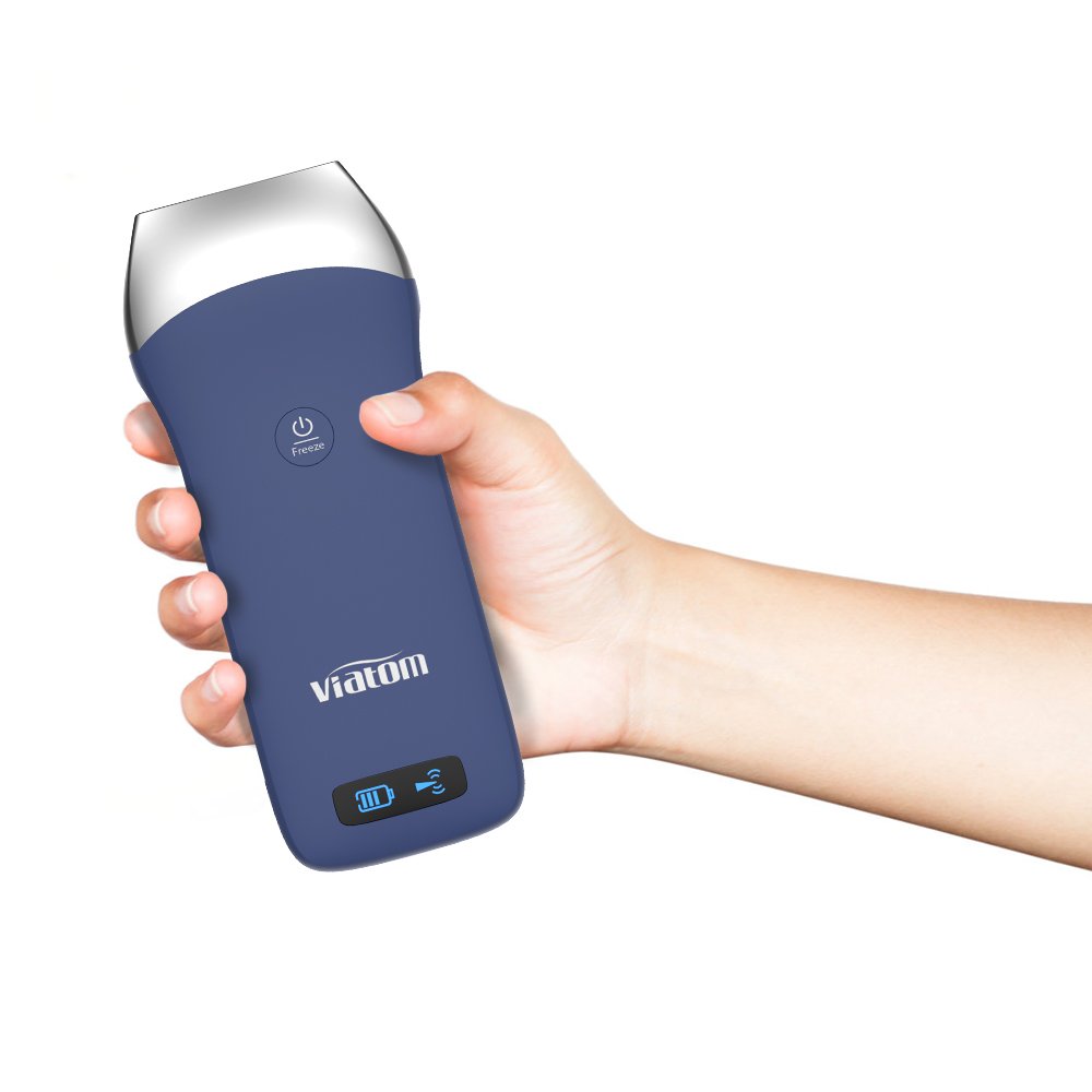 venta de ultrasonidos5
