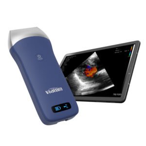 Ultrasonido Portatil Wifi Con Transductor Nuevo